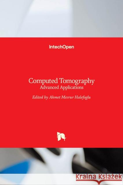 Computed Tomography: Advanced Applications Ahmet Mesrur Halefoglu 9789535133674 Intechopen - książka