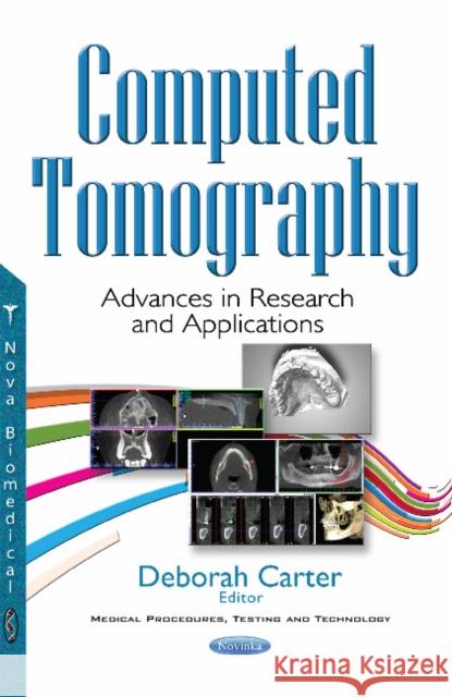 Computed Tomography: Advances in Research & Applications Deborah Carter 9781536107661 Nova Science Publishers Inc - książka