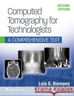 Computed Tomography for Technologists: A Comprehensive Text Lois Romans 9781496375858 Lippincott Williams and Wilkins - książka