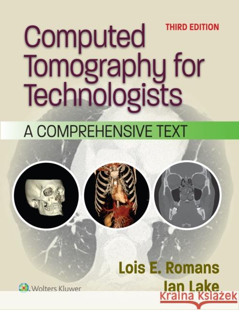 Computed Tomography for Technologists: A Comprehensive Text LOIS E., BA,RT(R)(CT) ROMANS 9781975232931 LWW - książka