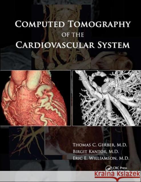 Computed Tomography of the Cardiovascular System Thomas C. Gerber Birgit Kantor Eric E. Williamson 9780367387839 CRC Press - książka