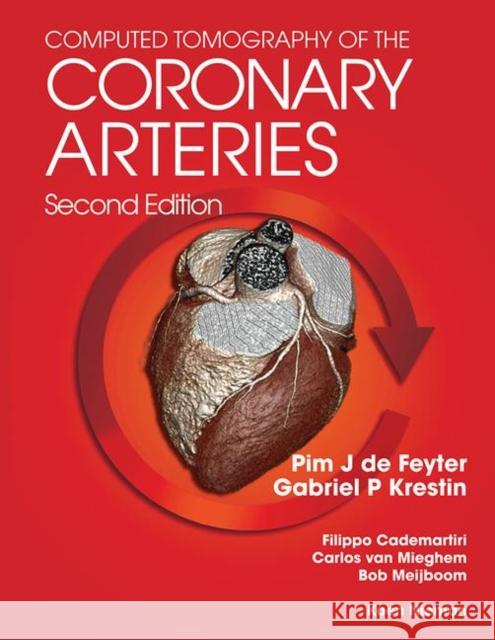 Computed Tomography of the Coronary Arteries Pim J. de Feyter G. P.  Gabriel Krestin  9780367452568 CRC Press - książka