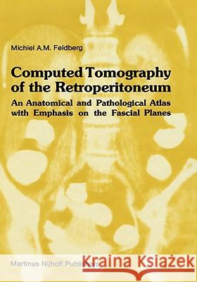 Computed Tomography of the Retroperitoneum: An Anatomical and Pathological Atlas with Emphasis on the Fascial Planes Feldberg, Michiel A. M. 9780898385731 KLUWER ACADEMIC PUBLISHERS GROUP - książka