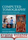 Computed Tomography: Physical Principles, Patient Care, Clinical Applications, and Quality Control Euclid Seeram 9780323790635 Saunders