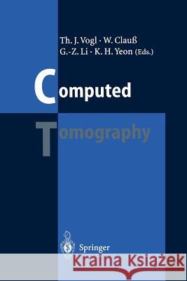 Computed Tomography: State of the Art and Future Applications Vogl, Thomas J. 9783642798894 Springer - książka