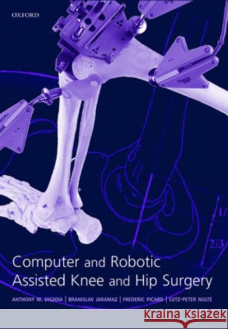 Computer and Robotic Assisted Hip and Knee Surgery Anthony Digioia Branislav Jaramaz Frederick Picard 9780198509431 Oxford University Press - książka
