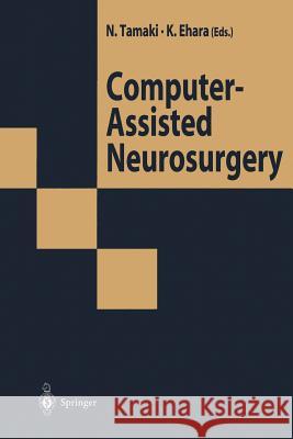 Computer-Assisted Neurosurgery Norihiko Tamaki Kazumasa Ehara 9784431658917 Springer - książka