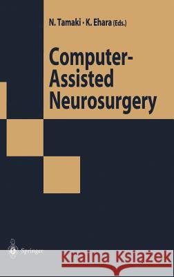 Computer-Assisted Neurosurgery N. Tamaki Japanese Society of Computers in Neurosu Norihiko Tamaki 9784431702115 Springer - książka