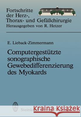 Computergestützte Sonographische Gewebedifferenzierung Des Myokards: Habilitationsschrift, Zur Erlangung Der Venia Legendi an Dem Universitätsklinikum Lieback-Zimmermann, Evelin 9783798509504 Not Avail - książka