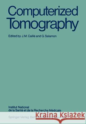 Computerized Tomography J. M. Caille G. Salamon 9783540098089 Springer - książka