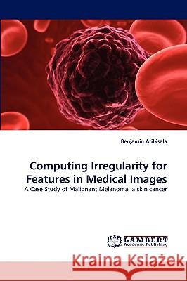Computing Irregularity for Features in Medical Images Benjamin Aribisala 9783838387635 LAP Lambert Academic Publishing - książka