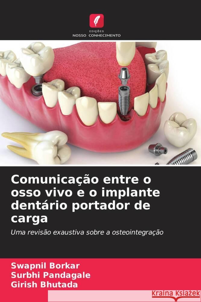 Comunica??o entre o osso vivo e o implante dent?rio portador de carga Swapnil Borkar Surbhi Pandagale Girish Bhutada 9786206884835 Edicoes Nosso Conhecimento - książka