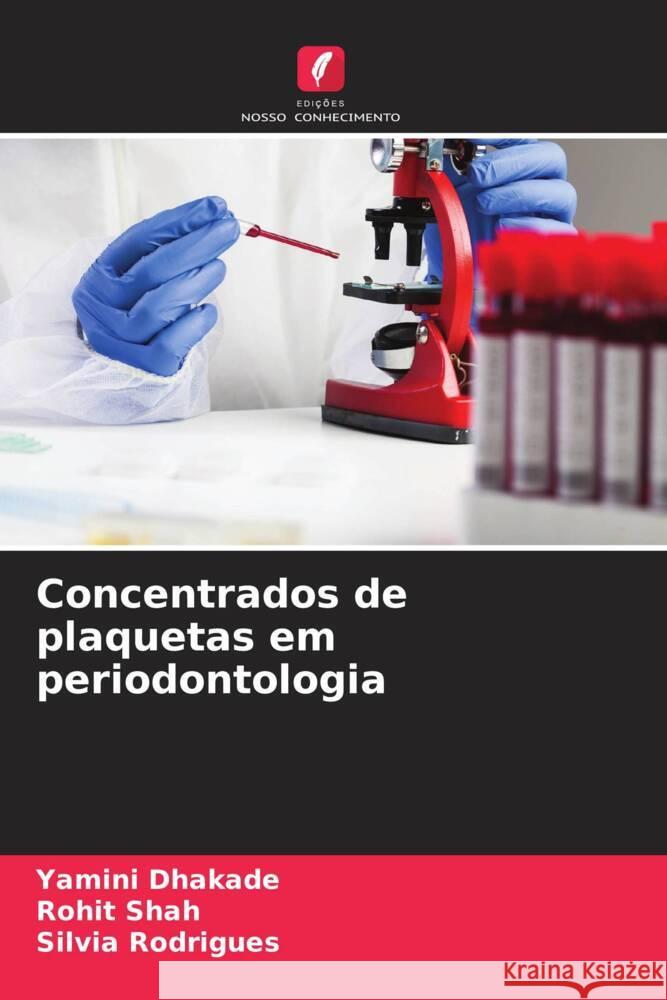 Concentrados de plaquetas em periodontologia Yamini Dhakade Rohit Shah Silvia Rodrigues 9786206622819 Edicoes Nosso Conhecimento - książka