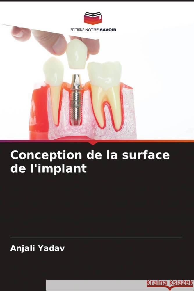 Conception de la surface de l'implant Yadav, Anjali 9786204417844 Editions Notre Savoir - książka