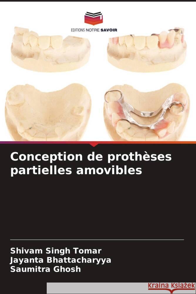 Conception de proth?ses partielles amovibles Shivam Singh Tomar Jayanta Bhattacharyya Saumitra Ghosh 9786207505463 Editions Notre Savoir - książka