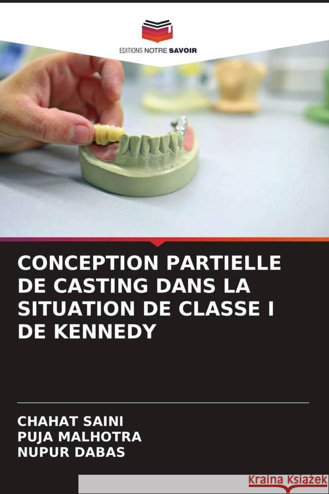 CONCEPTION PARTIELLE DE CASTING DANS LA SITUATION DE CLASSE I DE KENNEDY SAINI, Chahat, MALHOTRA, Puja, DABAS, Nupur 9786204702148 Editions Notre Savoir - książka