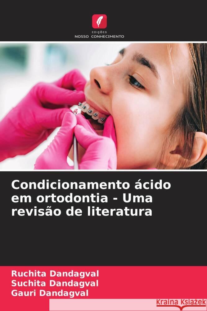 Condicionamento acido em ortodontia - Uma revisao de literatura Ruchita Dandagval Suchita Dandagval Gauri Dandagval 9786206246305 Edicoes Nosso Conhecimento - książka