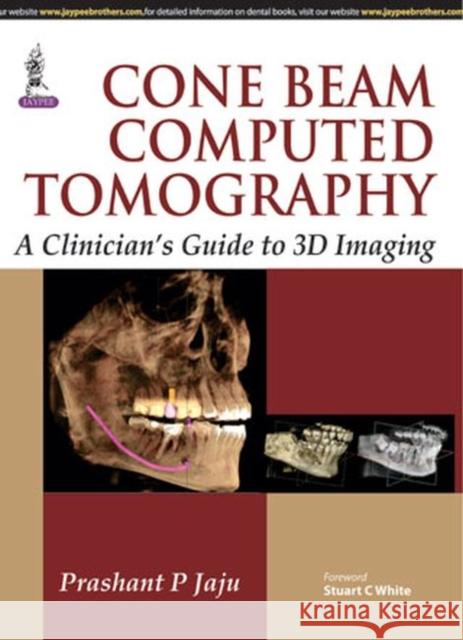 Cone Beam Computed Tomography  Jaju, Prashant P. 9789351526391  - książka