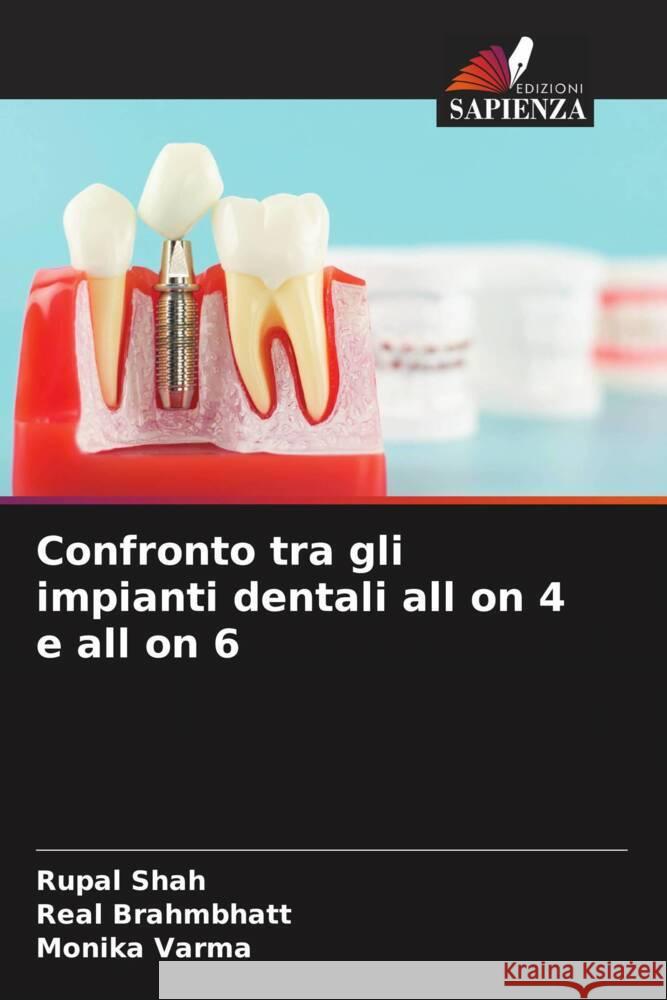 Confronto tra gli impianti dentali all on 4 e all on 6 Rupal Shah Real Brahmbhatt Monika Varma 9786203553109 Edizioni Sapienza - książka