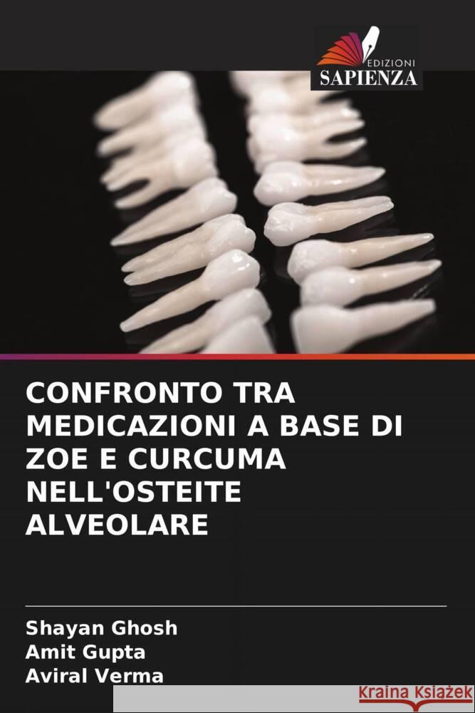Confronto Tra Medicazioni a Base Di Zoe E Curcuma Nell'osteite Alveolare Shayan Ghosh Amit Gupta Aviral Verma 9786208053987 Edizioni Sapienza - książka