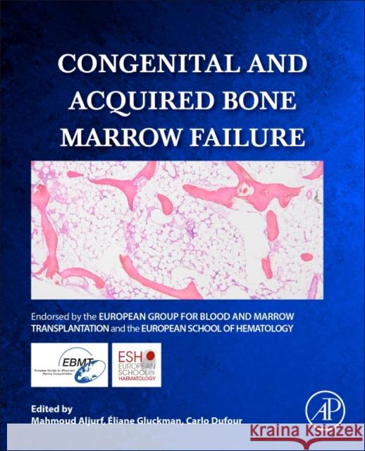 Congenital and Acquired Bone Marrow Failure Eliane Gluckman Mahmoud Deeb Aljurf Carlo Dufour 9780128041529 Elsevier Science Publishing Co Inc - książka