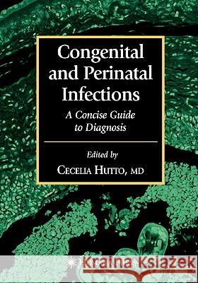 Congenital and Perinatal Infections Cecelia Hutto Gwendolyn B. Scott 9781617374791 Springer - książka