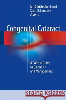 Congenital Cataract: A Concise Guide to Diagnosis and Management Lloyd, Ian Christopher 9783319278469 Springer - książka