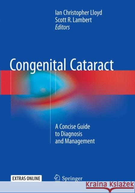 Congenital Cataract: A Concise Guide to Diagnosis and Management Lloyd, Ian Christopher 9783319802299 Springer - książka