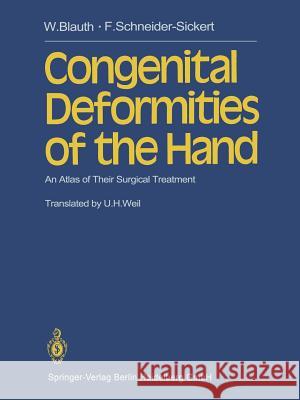 Congenital Deformities of the Hand: An Atlas of Their Surgical Treatment Blauth, W. 9783642676567 Springer - książka