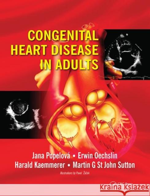 Congenital Heart Disease in Adults Jana Popelova, Erwin Oechslin, Harald Kaemmerer 9780367452575 Taylor and Francis - książka