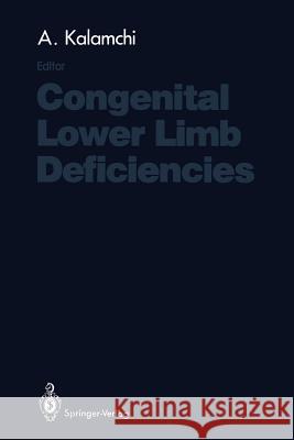 Congenital Lower Limb Deficiencies Ali Kalamchi 9781461388845 Springer - książka