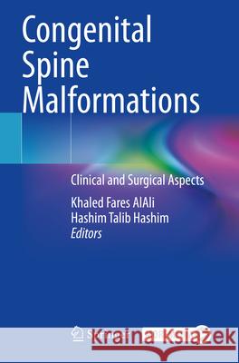 Congenital Spine Malformations: Clinical and Surgical Aspects Khaled Fares Alali Hashim Talib Hashim 9783031590337 Springer - książka