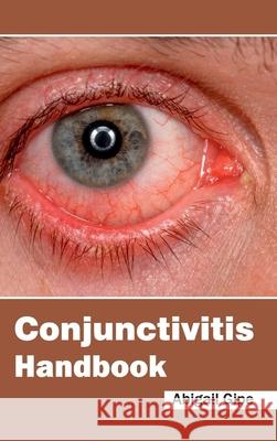 Conjunctivitis Handbook Abigail Gipe 9781632420930 Foster Academics - książka