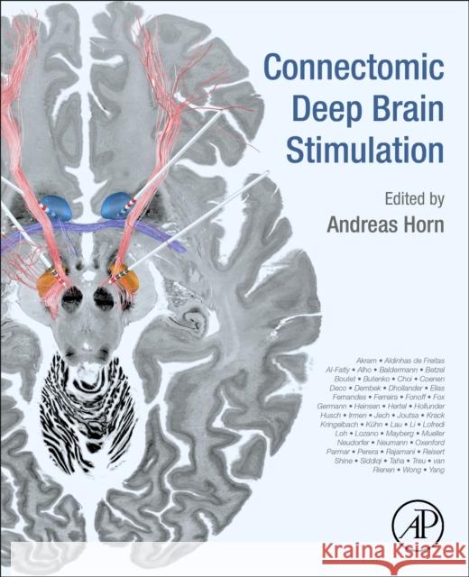 Connectomic Deep Brain Stimulation Andreas Horn 9780128218617 Academic Press - książka