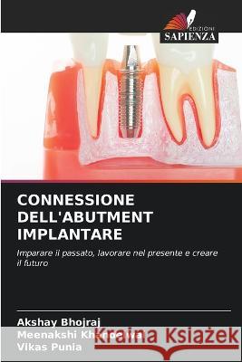 Connessione Dell'abutment Implantare Akshay Bhojraj Meenakshi Khandelwal Vikas Punia 9786205994054 Edizioni Sapienza - książka