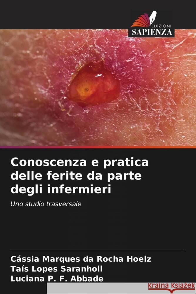 Conoscenza e pratica delle ferite da parte degli infermieri C?ssia Marques Da Rocha Hoelz Ta?s Lopes Saranholi Luciana P. F. Abbade 9786208536206 Edizioni Sapienza - książka
