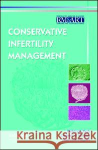 Conservative Infertility Management Christoph Keck Keck Keck Clemens B. Tempfer 9780415384513 Informa Healthcare - książka