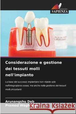 Considerazione e gestione dei tessuti molli nell'impianto Deb, Arunangshu, Waghmare, Pramod 9786208464912 Edizioni Sapienza - książka