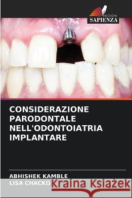 Considerazione Parodontale Nell'odontoiatria Implantare Abhishek Kamble Lisa Chacko  9786205888230 Edizioni Sapienza - książka