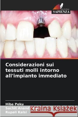 Considerazioni sui tessuti molli intorno all'impianto immediato Hiba Peku Sachit Anand Arora Rupali Kalsi 9786205321751 Edizioni Sapienza - książka