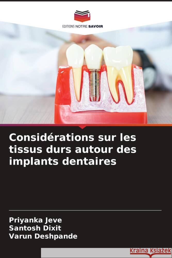 Consid?rations sur les tissus durs autour des implants dentaires Priyanka Jeve Santosh Dixit Varun Deshpande 9786206854166 Editions Notre Savoir - książka