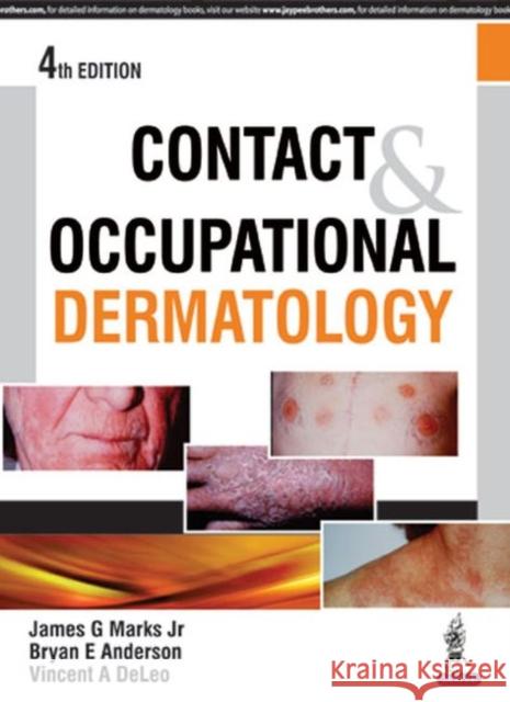 Contact & Occupational Dermatology James Marks 9789351529361 JP Medical Ltd - książka