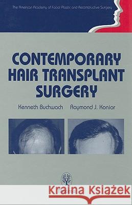 Contemporary Hair Transplant Surgery Kenneth A. Buchwach Raymond Konior 9780865775770 Thieme Medical Publishers - książka