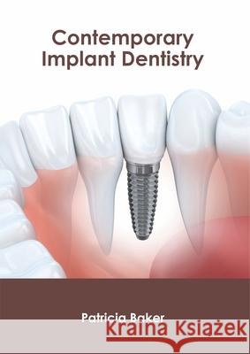 Contemporary Implant Dentistry Patricia Baker 9781632426109 Foster Academics - książka