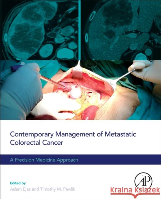 Contemporary Management of Metastatic Colorectal Cancer: A Precision Medicine Approach Timothy M. Pawlik Aslam Ejaz 9780323917063 Academic Press - książka