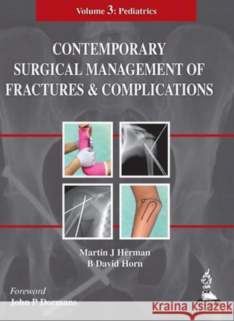 Contemporary Surgical Management of Fractures and Complications: Volume 3 - Pediatrics Herman, Martin J. 9789351521204 Jp Medical Ltd - książka