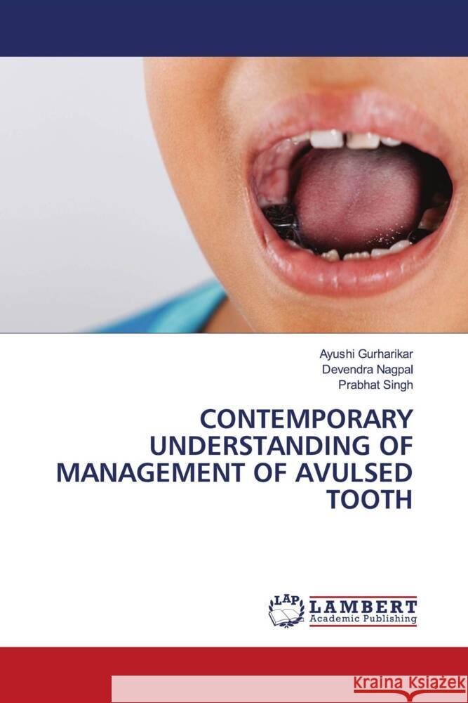 CONTEMPORARY UNDERSTANDING OF MANAGEMENT OF AVULSED TOOTH Gurharikar, Ayushi, Nagpal, Devendra, Singh, Prabhat 9786208427153 LAP Lambert Academic Publishing - książka