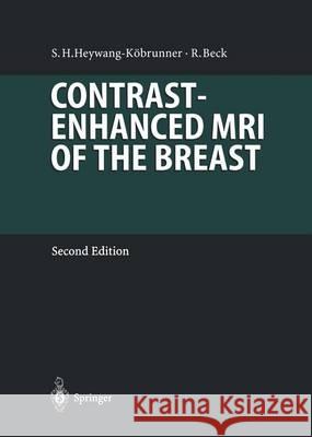 Contrast-Enhanced MRI of the Breast Sylvia Heywang- Rainer Beck T. Hilbertz 9783642646294 Springer - książka