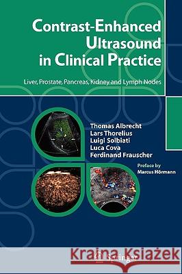 Contrast-Enhanced Ultrasound in Clinical Practice: Liver, Prostate, Pancreas, Kidney and Lymph Nodes Hörmann, M. 9788847003040 Springer - książka