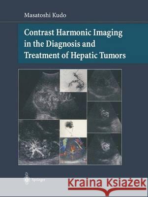 Contrast Harmonic Imaging in the Diagnosis and Treatment of Hepatic Tumors Masatoshi Kudo 9784431659068 Springer - książka